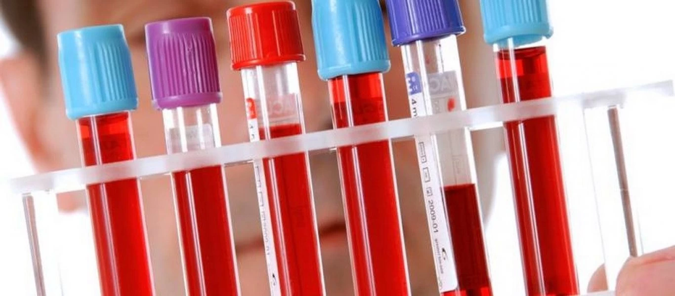 Δείτε ποιες είναι οι 7 αιτίες που προκαλούν αύξηση των λεμφοκυττάρων